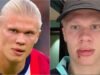 Erling Haaland mengalami cedera wajah yang parah di bus tim Norwegia