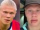 Erling Haaland mengalami cedera wajah yang parah di bus tim Norwegia