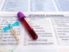 Kurangnya dana untuk biomarker kanker di Bulgaria memicu keluhan diskriminasi
