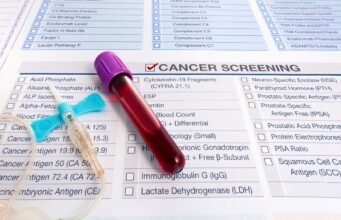 Kurangnya dana untuk biomarker kanker di Bulgaria memicu keluhan diskriminasi