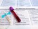 Kurangnya dana untuk biomarker kanker di Bulgaria memicu keluhan diskriminasi